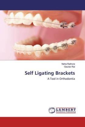 Self Ligating Brackets