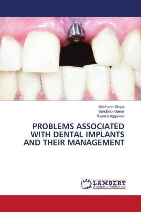 PROBLEMS ASSOCIATED WITH DENTAL IMPLANTS AND THEIR MANAGEMENT