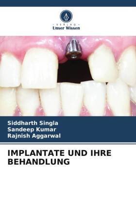 IMPLANTATE UND IHRE BEHANDLUNG