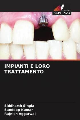 IMPIANTI E LORO TRATTAMENTO