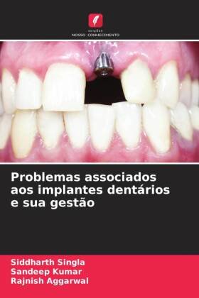 Problemas associados aos implantes dentários e sua gestão