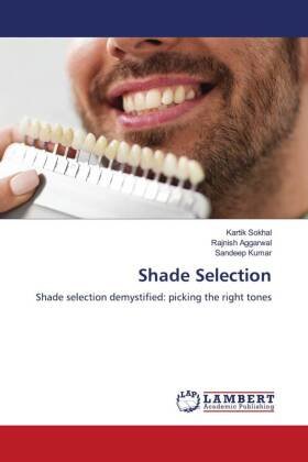 Shade Selection