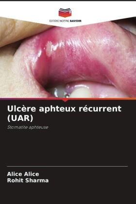 Ulcère aphteux récurrent (UAR)